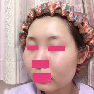67日目の経過画像（2枚目）