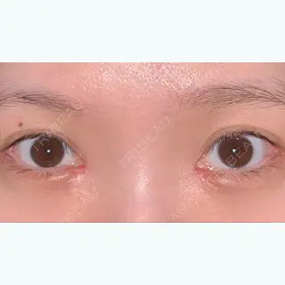 22日目の経過画像（1枚目）
