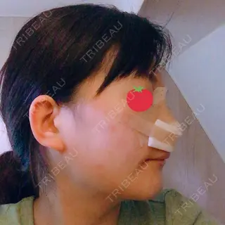 1日目の経過画像（3枚目）