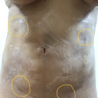 12日目の経過画像（1枚目）