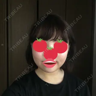 4日目の経過画像（1枚目）