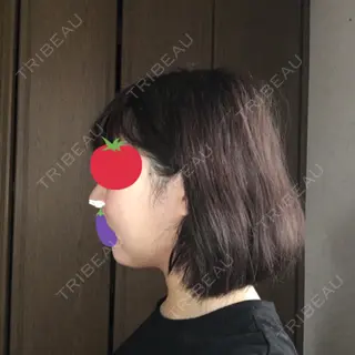 4日目の経過画像（2枚目）