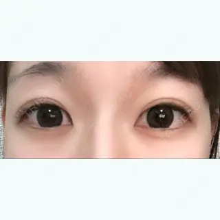 61日目の経過画像（1枚目）