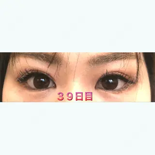 39日目の経過画像（1枚目）