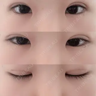 23日目の経過画像（1枚目）