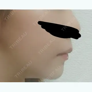 122日目の経過画像（1枚目）
