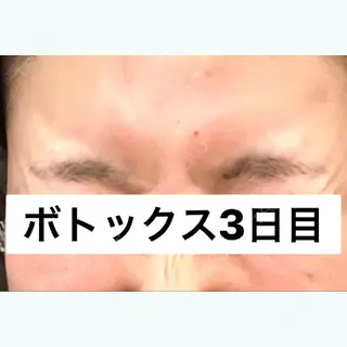 2日目の経過画像（1枚目）