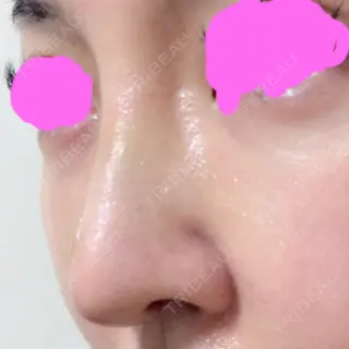 8日目の経過画像（3枚目）