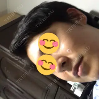 15日目の経過画像（2枚目）