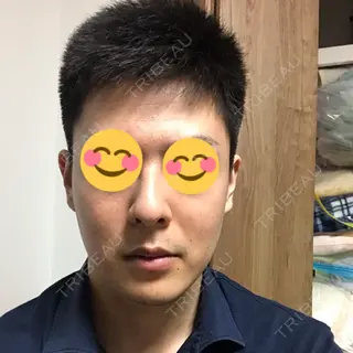 221日目の経過画像（1枚目）