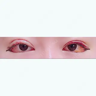 6日目の経過画像（1枚目）