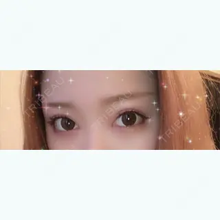 9日目の経過画像（2枚目）