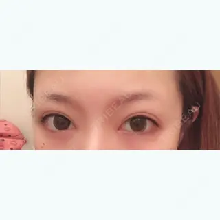 39日目の経過画像（1枚目）