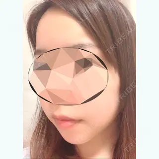 122日目の経過画像（3枚目）