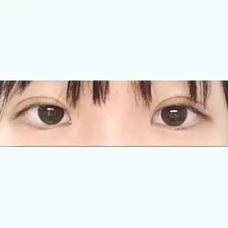 21日目の経過画像（1枚目）