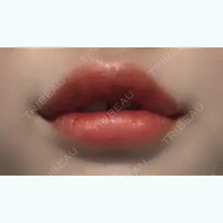2日目の経過画像（1枚目）