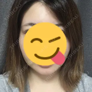 3日目の経過画像（1枚目）