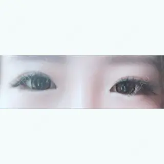 8日目の経過画像（2枚目）