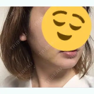 7日目の経過画像（2枚目）