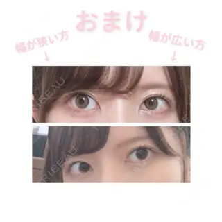 102日目の経過画像（3枚目）