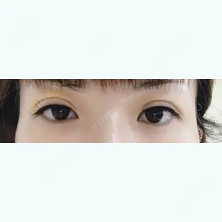 7日目の経過画像（1枚目）