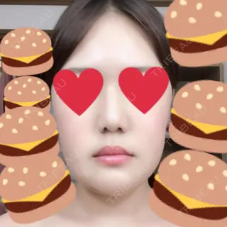 35日目の経過画像（1枚目）