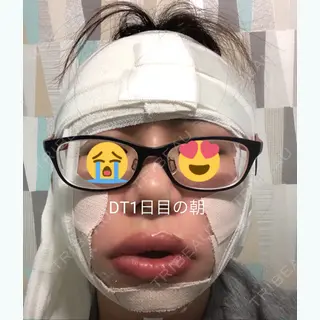 0日目の経過画像（2枚目）