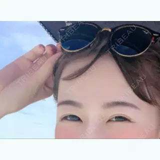 69日目の経過画像（1枚目）