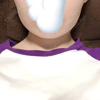 0日目の経過画像（1枚目）