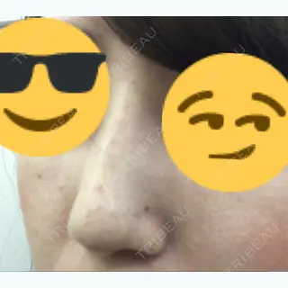 2日目の経過画像（2枚目）