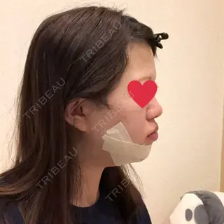 1日目の経過画像（2枚目）
