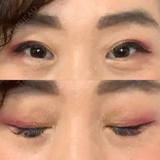 52日目の経過画像（1枚目）