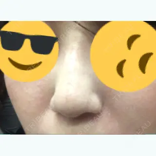 3日目の経過画像（2枚目）