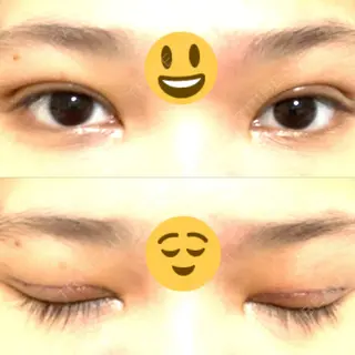 6日目の経過画像（1枚目）