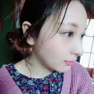 21日目の経過画像（1枚目）