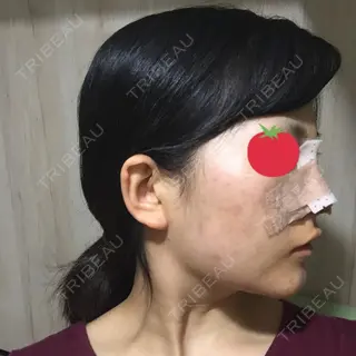 3日目の経過画像（3枚目）