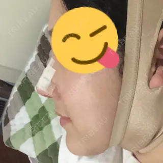 2日目の経過画像（2枚目）