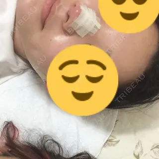 2日目の経過画像（1枚目）
