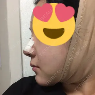 3日目の経過画像（2枚目）