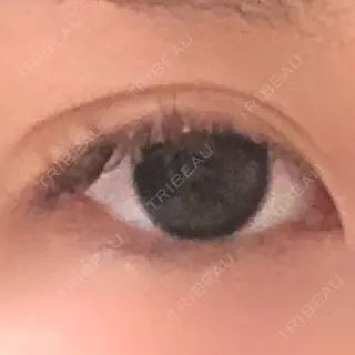 21日目の経過画像（1枚目）