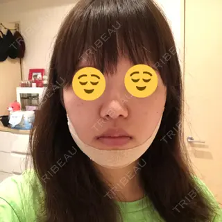 4日目の経過画像（1枚目）