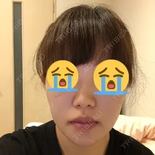 5日目の経過画像（1枚目）