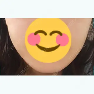 1日目の経過画像（1枚目）