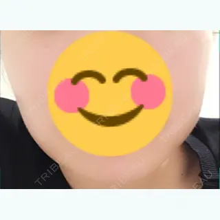 3日目の経過画像（1枚目）