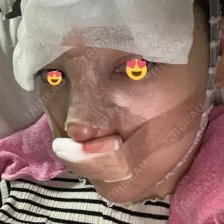 0日目の経過画像（3枚目）