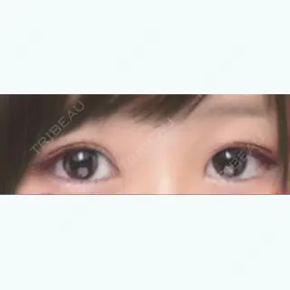 25日目の経過画像（1枚目）