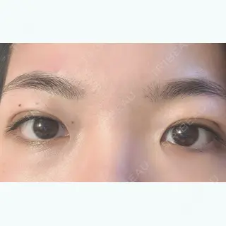 1日目の経過画像（1枚目）
