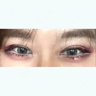 201日目の経過画像（2枚目）