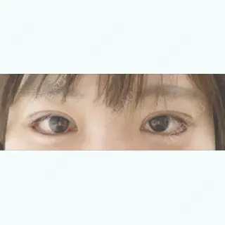 9日目の経過画像（1枚目）