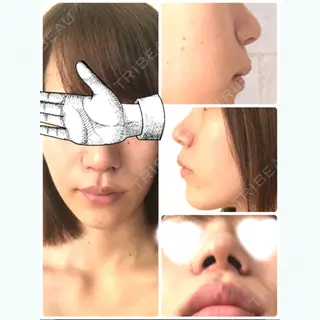 1日目の経過画像（1枚目）